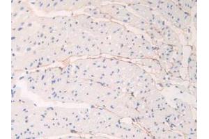 IHC-P analysis of Mouse Heart Tissue, with DAB staining. (Fibrillin 1 Antikörper  (AA 1701-1887))