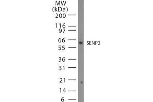 Image no. 1 for anti-SUMO1/sentrin/SMT3 Specific Peptidase 2 (SENP2) (AA 500-550) antibody (ABIN208758) (SENP2 Antikörper  (AA 500-550))