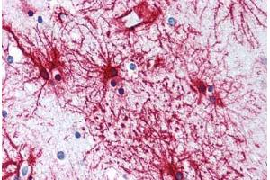 Human Brain, Cortex, Astrocytes (formalin-fixed, paraffin-embedded) stained with GFAP antibody ABIN305893 at 5 ug/ml followed by biotinylated anti-goat IgG secondary antibody ABIN481715, alkaline phosphatase-streptavidin and chromogen. (GFAP Antikörper  (AA 417-430))