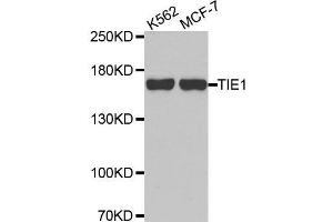 Western blot analysis of extracts of various cell lines, using TIE1 antibody. (TIE1 Antikörper  (AA 350-600))