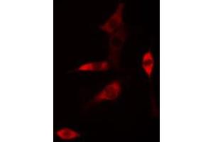 ABIN6268761 staining HUVEC cells by IF/ICC. (Claudin 6 Antikörper  (Internal Region))