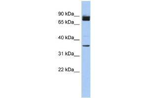 WB Suggested Anti-MGC48628 Antibody Titration: 0. (MGC48628 (N-Term) Antikörper)