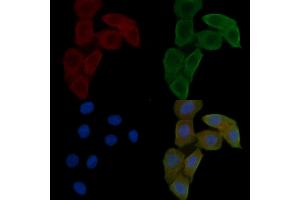 ABIN6262807 and ABIN6278585 staining Hela cells(24h of starvation treatment) by IF/ICC. (KIF20A Antikörper  (C-Term))