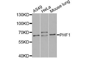 Western blot analysis of extracts of various cell lines, using PHF1 antibody (ABIN5974685) at 1/1000 dilution. (PHF1 Antikörper)