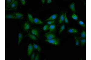 Immunofluorescence staining of Hela cells with ABIN7159545 at 1:133, counter-stained with DAPI. (MT3 Antikörper  (AA 1-68))