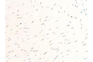 Immunohistochemistry (IHC) image for anti-Baculoviral IAP Repeat-Containing 5 (BIRC5) (pThr117) antibody (ABIN6255588)
