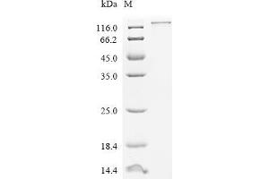 (Tris-Glycine gel) Discontinuous SDS-PAGE (reduced) with 5 % enrichment gel and 15 % separation gel.