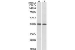 ABIN5539769 (1µg/ml) staining of Human Heart (A) and Lung (B) lysates (35µg protein in RIPA buffer).
