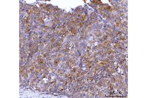 IHC analysis of AGPS using anti-AGPS antibody (ABIN7600146).