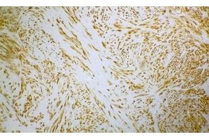Image no. 1 for anti-Desmin (DES) antibody (ABIN335365) (Desmin Antikörper)