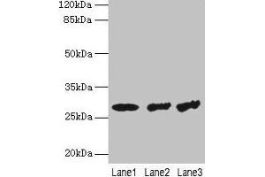 Western blot All lanes: TBCB antibody at 4 μg/mL Lane 1: Hela whole cell lysate Lane 2: A549 whole cell lysate Lane 3: Jurkat whole cell lysate Secondary Goat polyclonal to rabbit IgG at 1/10000 dilution Predicted band size: 28, 22 kDa Observed band size: 28 kDa