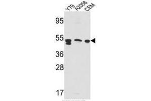 Western blot analysis of SAP Antibody (Center E300) in Y79,A2058,CEM cell line lysates(35ug/lane). (Prosaposin Antikörper  (Middle Region))