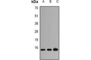 Western blot analysis of Profilin 1 expression in HT29 (A), PC12 (B), COS7 (C) whole cell lysates. (PFN1 Antikörper)