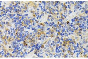 Immunohistochemistry of paraffin-embedded Mouse spleen using TREM2 Polyclonal Antibody at dilution of 1:200 (40x lens). (TREM2 Antikörper)