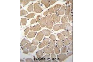 GAS2L2 Antibody (C-term) (ABIN655364 and ABIN2844921) immunohistochemistry analysis in formalin fixed and paraffin embedded human skeletal muscle followed by peroxidase conjugation of the secondary antibody and DAB staining. (GAS2L2 Antikörper  (C-Term))