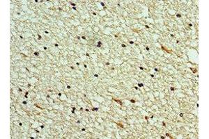 Immunohistochemistry (IHC) image for anti-C-Type Lectin Domain Family 11, Member A (CLEC11A) (AA 22-323) antibody (ABIN7146050)
