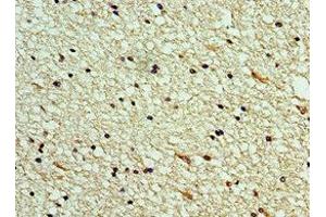Immunohistochemistry of paraffin-embedded human brain tissue using ABIN7146050 at dilution of 1:100 (CLEC11A Antikörper  (AA 22-323))