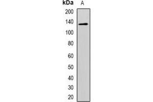 Western blot analysis of CD146 expression in Hela (A) whole cell lysates. (MCAM Antikörper)