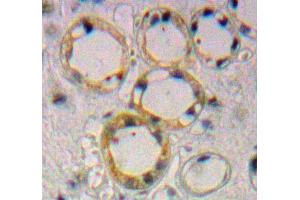 Used in DAB staining on fromalin fixed paraffin-embedded Kidney tissue (Endoglin Antikörper  (AA 336-450))