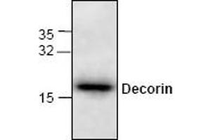 Image no. 1 for anti-Decorin (DCN) antibody (ABIN264841) (Decorin Antikörper)