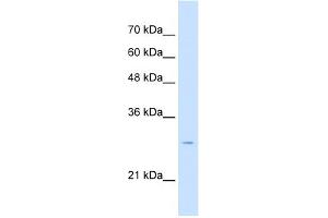 WB Suggested Anti-TSPAN32 Antibody Titration:  2. (TSPAN32 Antikörper  (Middle Region))