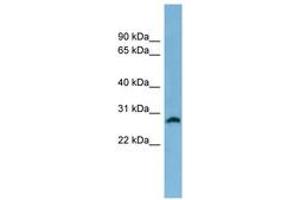 Image no. 1 for anti-Steroid-5-alpha-Reductase, alpha Polypeptide 2 (3-Oxo-5 alpha-Steroid delta 4-Dehydrogenase alpha 2) (SRD5A2) (AA 35-84) antibody (ABIN6744768) (SRD5A2 Antikörper  (AA 35-84))