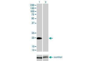 Western blot analysis of STK32A over-expressed 293 cell line, cotransfected with STK32A Validated Chimera RNAi (Lane 2) or non-transfected control (Lane 1).