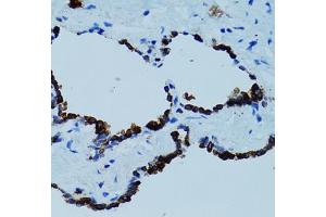 Immunohistochemistry of paraffin-embedded human lung using CTSE antibody (ABIN5971444) at dilution of 1/100 (40x lens). (Cathepsin E Antikörper)