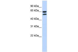 ACOT11 antibody used at 1 ug/ml to detect target protein. (ACOT11 Antikörper  (Middle Region))