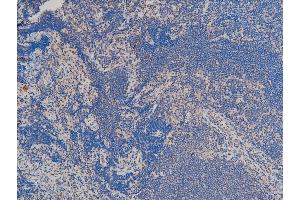 Immunohistochemistry (IHC) image for anti-LIM Domain Kinase 1 (LIMK1) (pThr508) antibody (ABIN6255701)