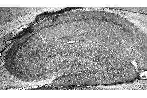 Adult rat hippocampus immunohistochemistry.