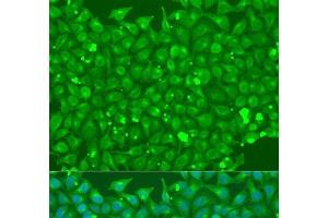 Immunofluorescence analysis of U2OS cells using FLT4 Polyclonal Antibody at dilution of 1:100. (FLT4 Antikörper)