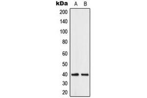 Western blot analysis of ABHD12B expression in human brain (A), K562 (B) whole cell lysates. (ABHD12B Antikörper  (C-Term))