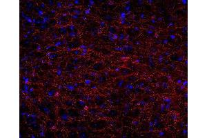 Indirect immunostaining of PFA fixed rat brain section (dilution 1 : 500; red). (Cnpase Antikörper  (AA 1-420))