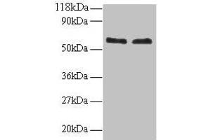 Western blot All lanes: FUS antibody at 2 μg/mL Lane 1: 293T whole cell lysate Lane 2: EC109 whole cell lysate Secondary Goat polyclonal to rabbit IgG at 1/15000 dilution Predicted band size: 54 kDa Observed band size: 60 kDa (FUS Antikörper  (AA 1-198))