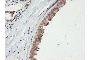 Immunohistochemical staining of paraffin-embedded Human breast tissue using anti-ENPEP mouse monoclonal antibody. (ENPEP Antikörper)