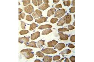 Immunohistochemistry analysis in formalin fixed and paraffin embedded human skeletal muscle reacted with hCG_1645727 Antibody (C-term) followed by peroxidase conjugation of the secondary antibody and DAB staining. (KBTBD13 Antikörper  (C-Term))
