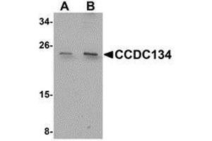 Western blot analysis of CCDC134 in rat brain tissue lysate with AP30210PU-N CCDC134 antibody at (A) 1 and (B) 2 μg/ml. (CCDC134 Antikörper  (N-Term))