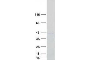 Validation with Western Blot