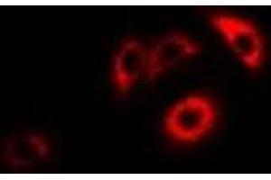 Immunofluorescent analysis of ERp46 staining in HepG2 cells. (TXNDC5 Antikörper)