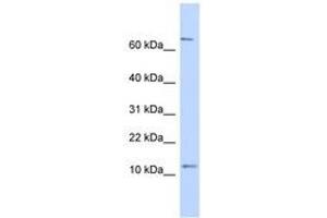 Image no. 1 for anti-Nuclear Receptor 2C2-Associated Protein (NR2C2AP) (N-Term) antibody (ABIN6741243) (NR2C2AP Antikörper  (N-Term))