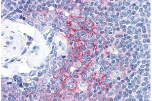 Human Spleen (formalin-fixed, paraffin-embedded) stained with ICAM1 antibody ABIN337366 at 10 ug/ml followed by biotinylated anti-mouse IgG secondary antibody ABIN481714, alkaline phosphatase-streptavidin and chromogen. (ICAM1 Antikörper)