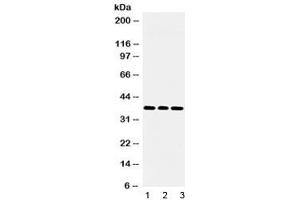 Western blot testing of 1) rat brain, 2) mouse NIH 3T3 and 3) human U-2 OS lysate with LDHB antibody at 0.