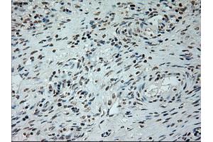 Immunohistochemical staining of paraffin-embedded lung tissue using anti-L1CAMmouse monoclonal antibody. (L1CAM Antikörper)