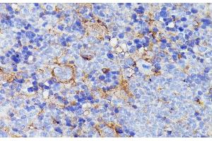 Immunohistochemistry of paraffin-embedded Mouse spleen using SNAP23 Polyclonal Antibody at dilution of 1:100 (40x lens). (SNAP23 Antikörper)