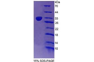 SDS-PAGE analysis of Human Cullin 1 Protein. (Cullin 1 Protein (CUL1))