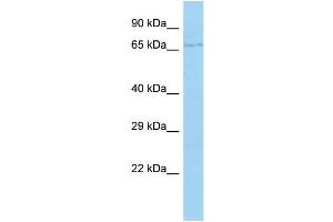 Western Blotting (WB) image for anti-Cytochrome P450, Family 4, Subfamily F, Polypeptide 22 (CYP4F22) (Middle Region) antibody (ABIN2790749)