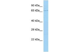 Host: Rabbit Target Name: CYP4F22 Sample Type: 721_B Whole Cell lysates Antibody Dilution: 1. (CYP4F22 Antikörper  (Middle Region))