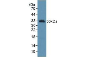 Detection of Recombinant KLK2, Human using Monoclonal Antibody to Kallikrein 2 (KLK2) (Kallikrein 2 Antikörper  (AA 19-261))