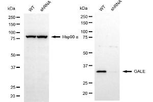 Western blotting analysis using GALE antibody (ABIN7800765). (GALE Antikörper)